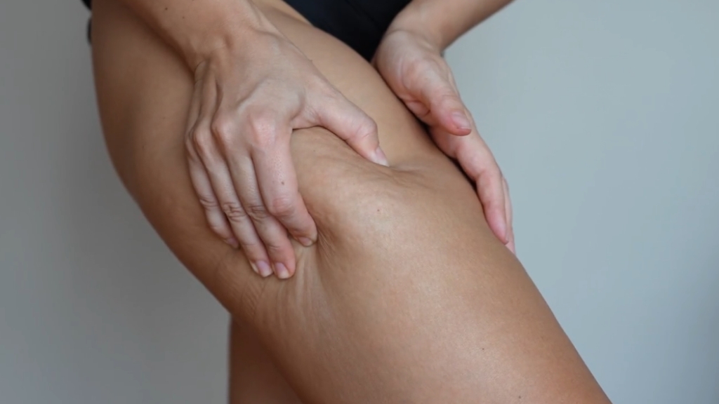 Osoba masira područje noge, pokušava da se reši celulita