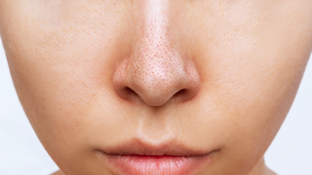 Mitiseri na nosu izbliza