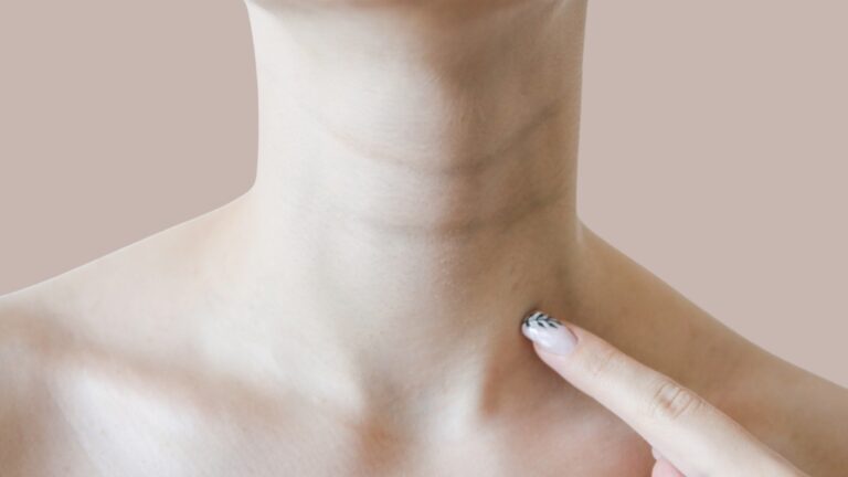 Kako sprečiti bore na vratu već u tridesetim?